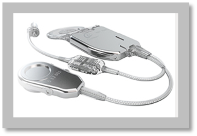Implants iom